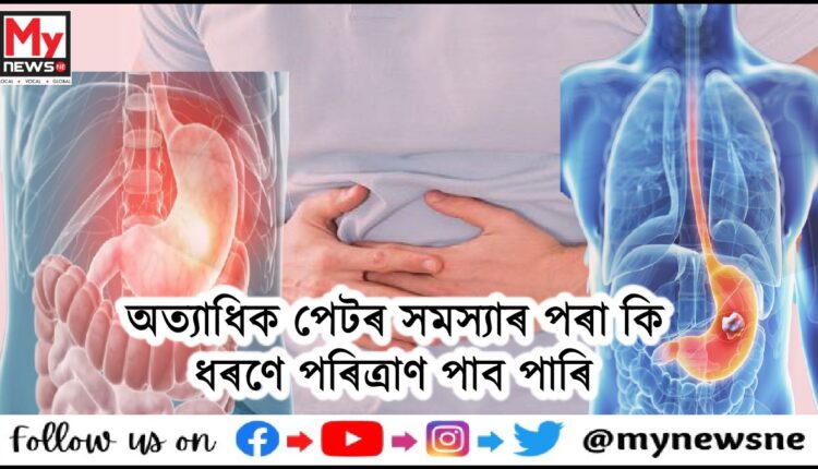: জানো আঁহক অত্যাধিক পেটৰ সমস্যাৰ পৰা কিধৰণে পৰিত্ৰাণ পাব পাৰি