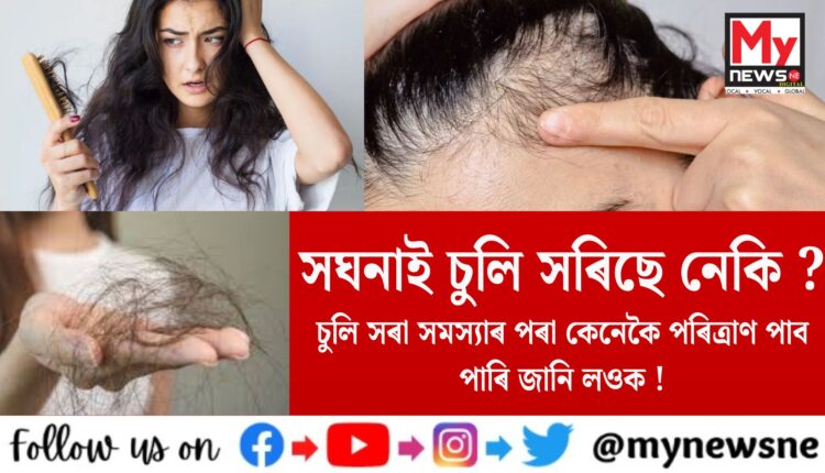 সঘনাই চুলি সৰিছে নেকি ? চুলি সৰা সমস্যাৰ পৰা কেনেকৈ পৰিত্ৰাণ পাব পাৰি জানি লওক !