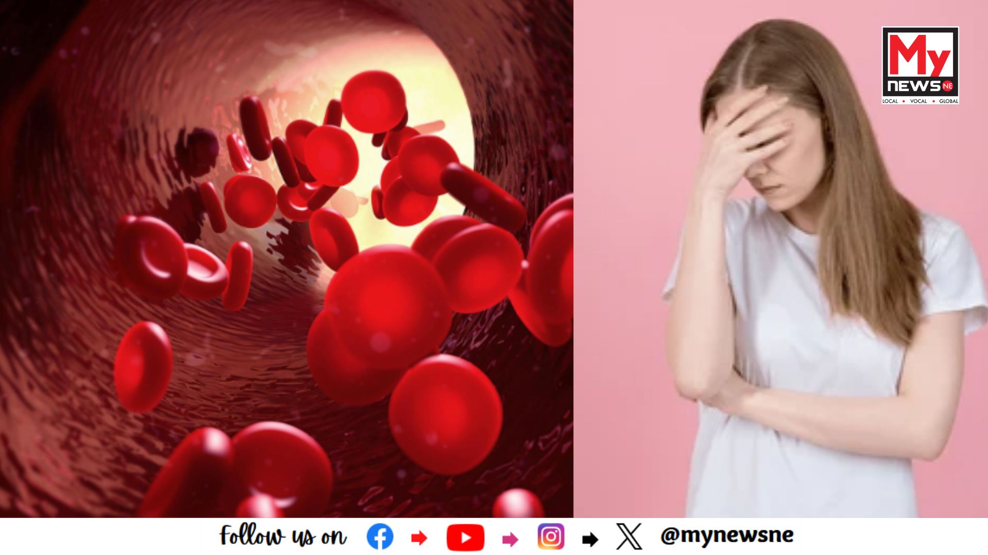 Do you know what foods help to relieve iron deficiency in the body: কি খাদ্যই শৰীৰত আইৰণৰ অভাৱ দূৰ কৰাত সহায়ক জানেনে ?